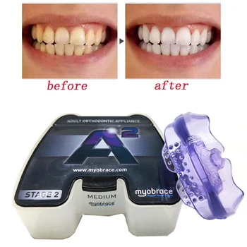 3 Етапа A2 Myobrace Стоматологичен Ортодонтический Уред за Изравняване на Зъбите Тиранти Симулатор за Зъби за Възрастни Инструменти за Избелване на Зъбите