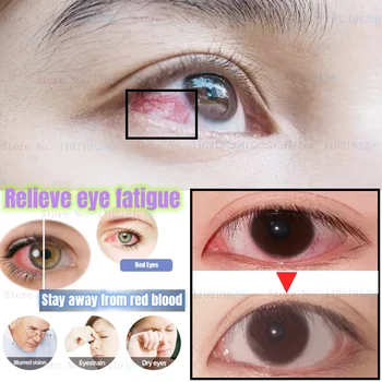 Елиминира зачервяване и подуване на Овлажнява очите Охлажда очи Облекчава умората на очите Съдържа три витамин за облекчаване на сухота в очите капки за очи 0