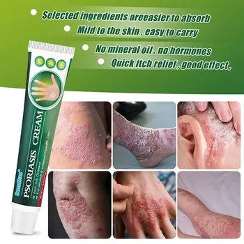 Грижа за кожата Преносим Крем за външно приложение Skinmedix Care Cream Zlimplify Кремове от сърбеж Крем за лицето и тялото за пречистване от опоясывающего лишаване 1